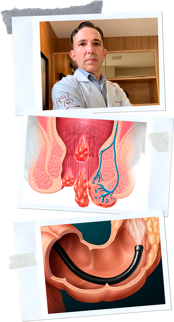 Dr. Gustavo Benevides - Especialista em Endoscopia Digestiva